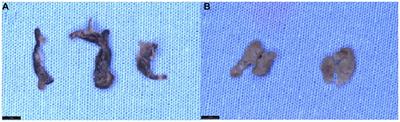 Quality assessment of histopathological stainings on prolonged formalin fixed thrombus tissues retrieved by mechanical thrombectomy